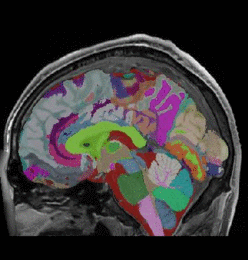 Parcellation of brain structures on a sagittal MRI